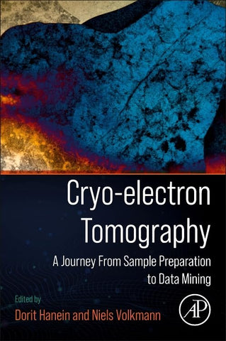 Cryo-Electron Tomography A Journey from Sample Preparation to Data Mining