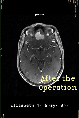 After the Operation